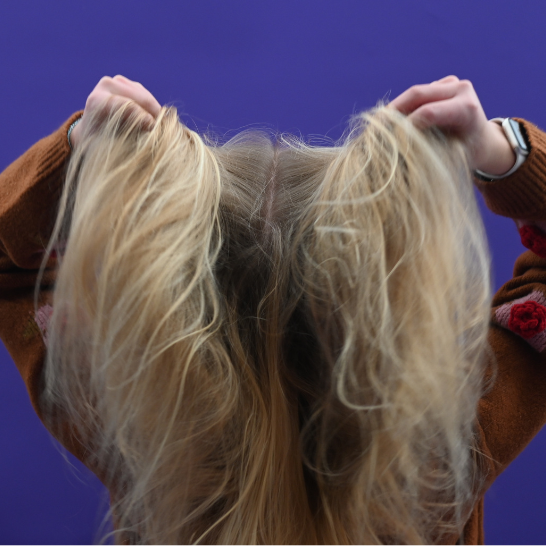 Frizzy hair: what it is, why it happens and how to care for frizzy hai